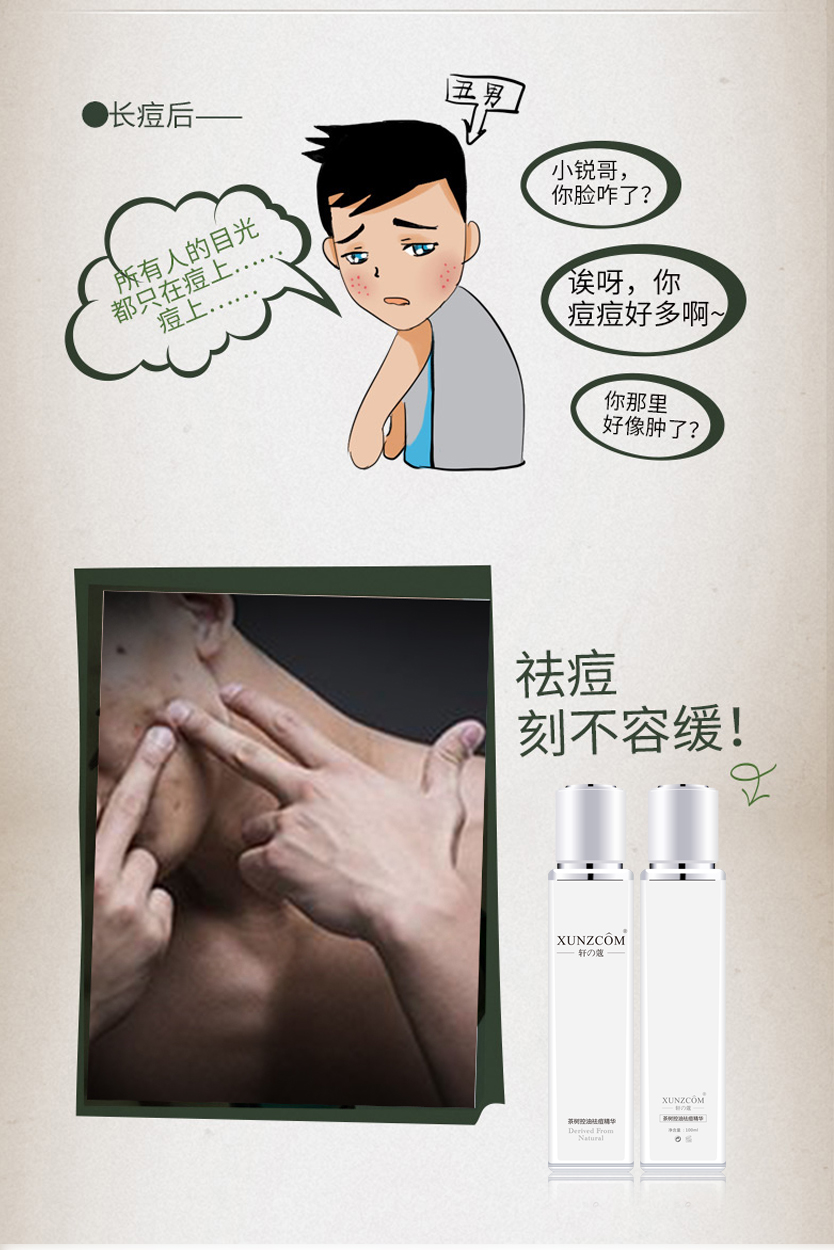 茶樹(shù)控油祛痘精華-歐泉生化