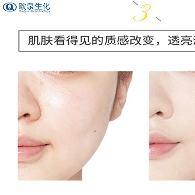 跟著廠(chǎng)家了解毛孔堵塞的兩種癥狀